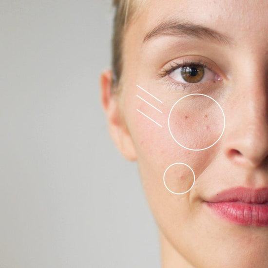 How We Age: Best devices for Teenage Skin