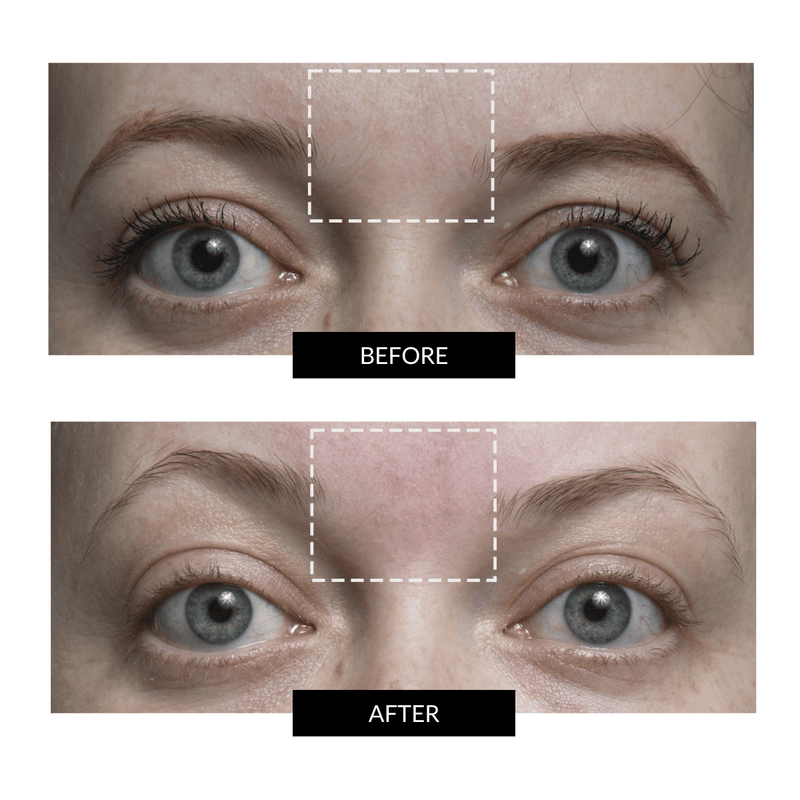 CurrentBody Skin RF Radio Frequency Skin Tightening Device CurrentBody HK