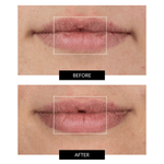 CurrentBody Skin LED Lip Perfector