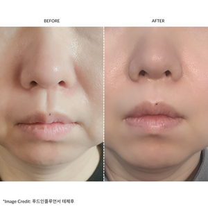 ZIIP HALO Facial Toning Device Offer