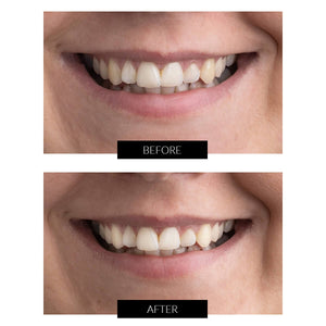FREE GIFT CurrentBody Skin Teeth Whitening Device