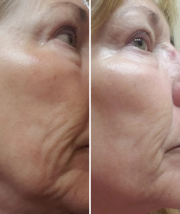Anti-Ageing Technology