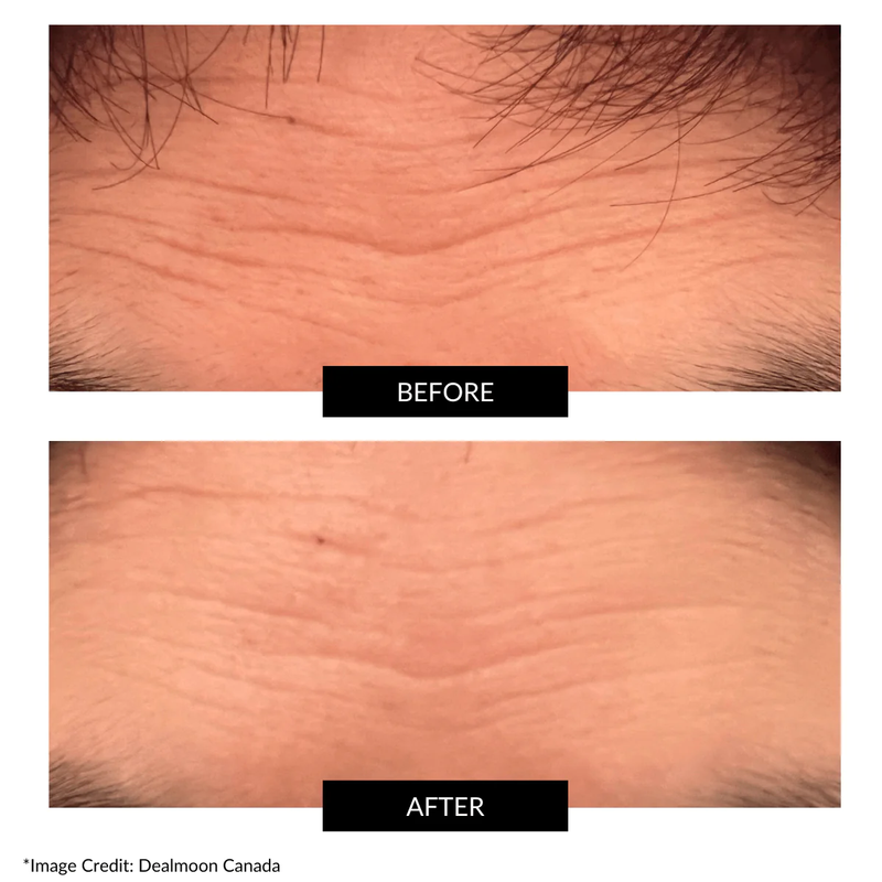 CurrentBody Skin RF Radio Frequency Skin Tightening Device CurrentBody HK