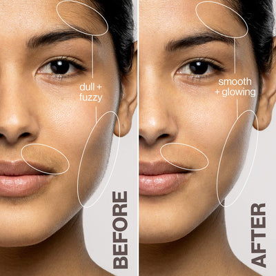 DERMAFLASH Luxe+ Anti-Ageing, Exfoliation + Peach Fuzz Removal Device