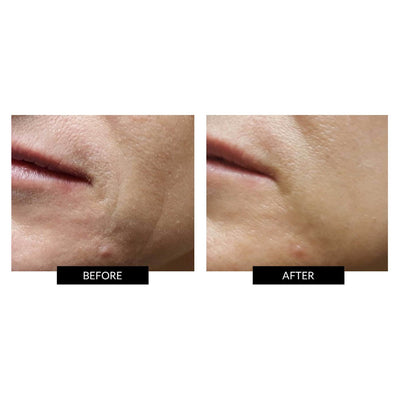 ZIIP Beauty GX Series Nano Current Skincare Device