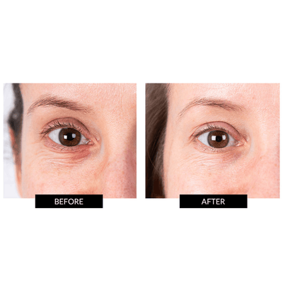 CurrentBody Skin LED Eye Perfector