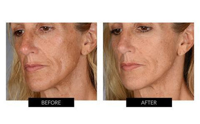 BeautyBio Skin That Glitters (worth HK$2900)
